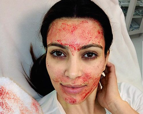 Ким Кардашьян будет судиться с косметологом из-за кровавой маски